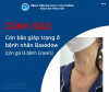 Biến chứng cơn bão giáp trạng ở bệnh nhân Basedow (còn gọi là bệnh Grave’s)