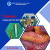Cảnh báo thủng ruột do xương cá